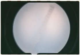 Frame 8
